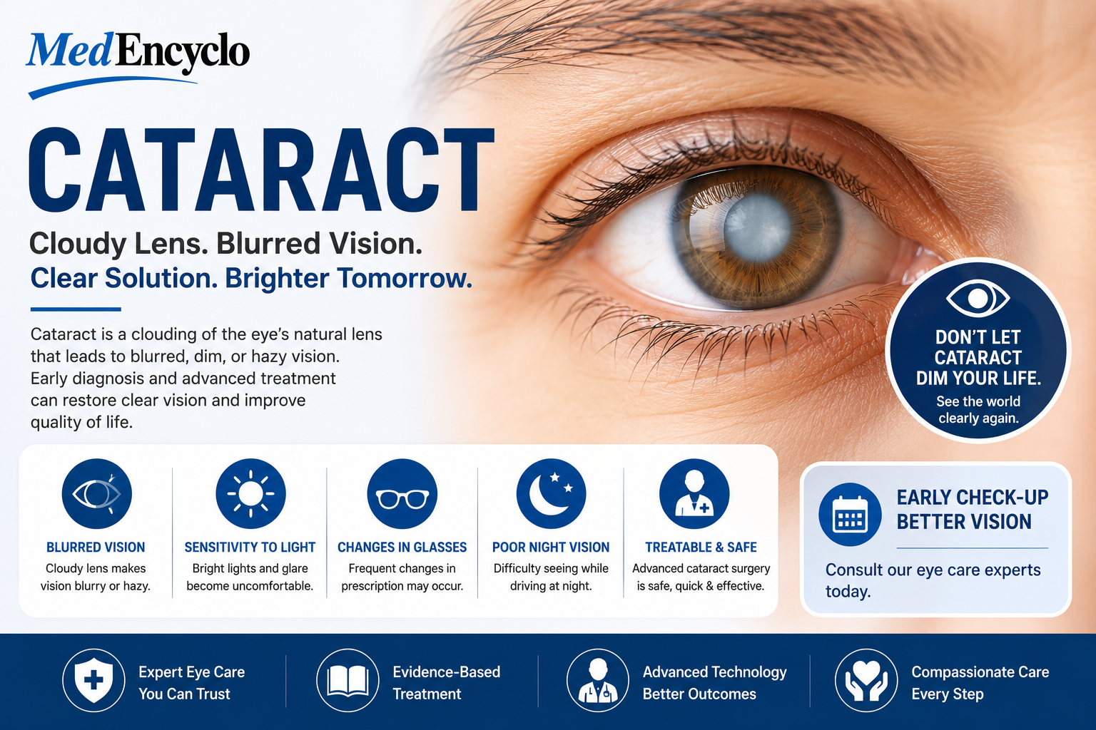 Cataract