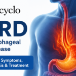 Gastroesophageal Reflux Disease