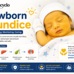 Neonatal Jaundice