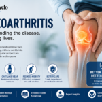 Osteoarthritis