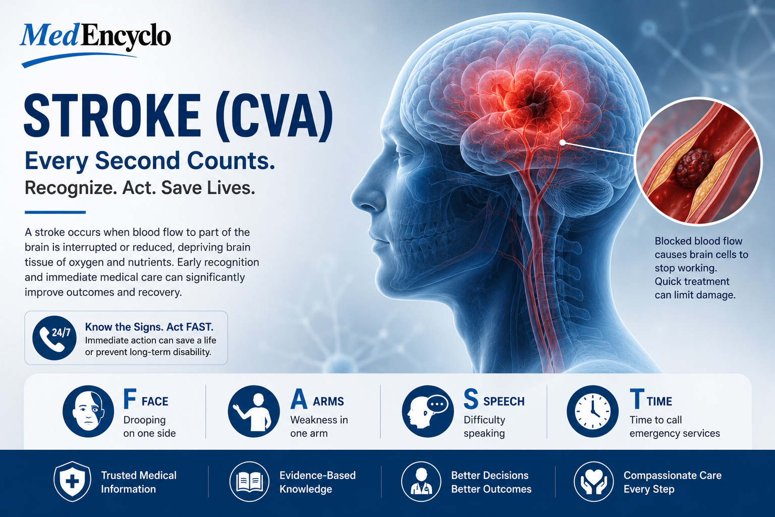 Stroke
